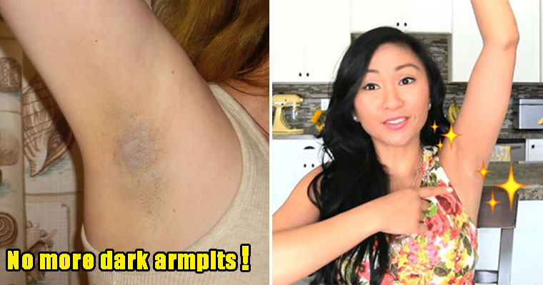 7 Reasons Some Malaysians Have Darker Armpits and How to Avoid Them - WORLD OF BUZZ 7