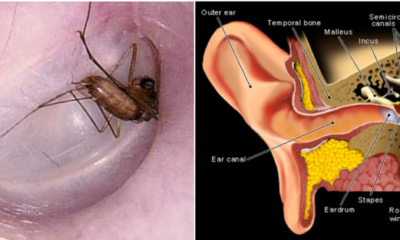 Bug Stuck Inside Your Ear? Don't Panic, Follow These Steps - WORLD OF BUZZ 6