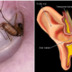 Bug Stuck Inside Your Ear? Don't Panic, Follow These Steps - WORLD OF BUZZ 6