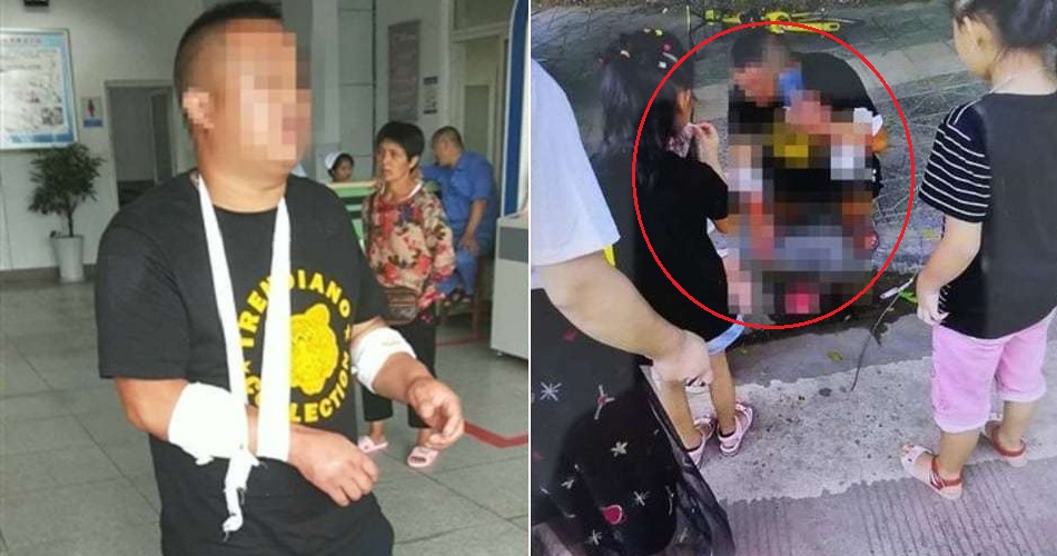 BF Stages Robbery, Slashes Own Arms to Get Away From Buying GF Luxurious Car - WORLD OF BUZZ