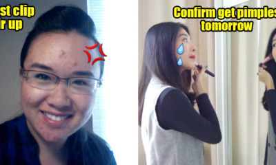 9 Real Struggles M'sians With Crazy Sensitive Skin Can Confirm Relate to - WORLD OF BUZZ 3