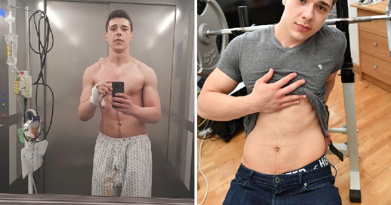 Man Believes His Ripped Six-Pack Abs Saved His Life When He Was Run Over by Truck - WORLD OF BUZZ 5