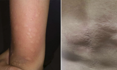 M'sian Couple Gets Bitten by 'Mites' Midway Through Movie at KL Mall - WORLD OF BUZZ