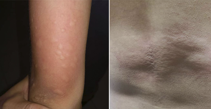 M'sian Couple Gets Bitten by 'Mites' Midway Through Movie at KL Mall - WORLD OF BUZZ