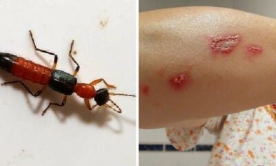 Penang Condo Residents Plagued By Venomous 'Charlie Ants', Here's What They Are - WORLD OF BUZZ 4