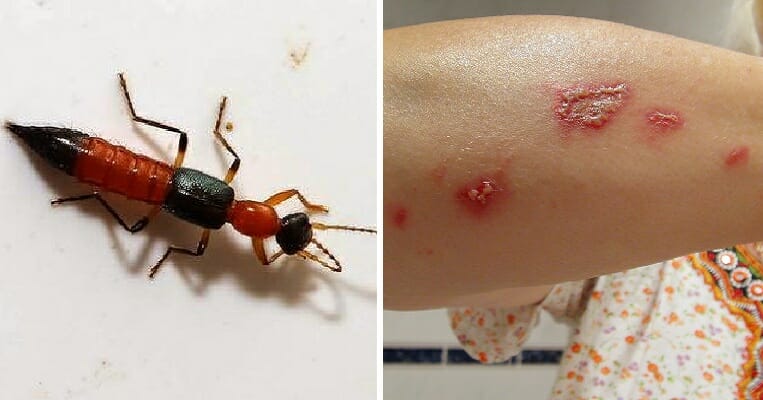 Penang Condo Residents Plagued By Venomous 'Charlie Ants', Here's What They Are - WORLD OF BUZZ 4