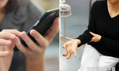 Woman Experiences Severe Pain and Paralysed Fingers After Playing Phone for A Week - WORLD OF BUZZ