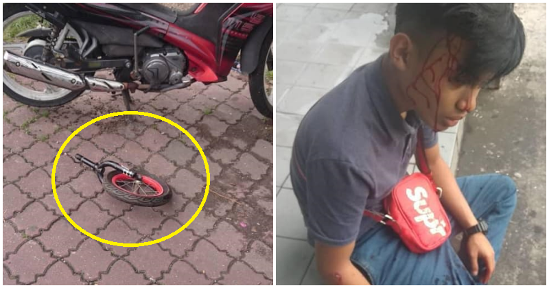 Boy's Head Left Bloodied After Being Struck By Bicycle Part Thrown From Flat in KL - WORLD OF BUZZ 1