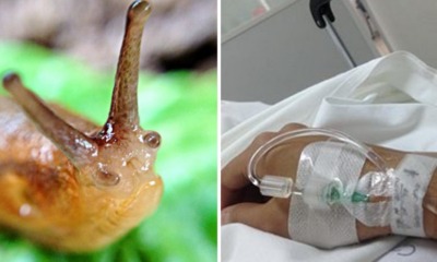 Teenager Dared by Friends to Eat Slug, Falls into Coma & Dies 8 Years Later - WORLD OF BUZZ 2