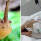Teenager Dared by Friends to Eat Slug, Falls into Coma & Dies 8 Years Later - WORLD OF BUZZ 2