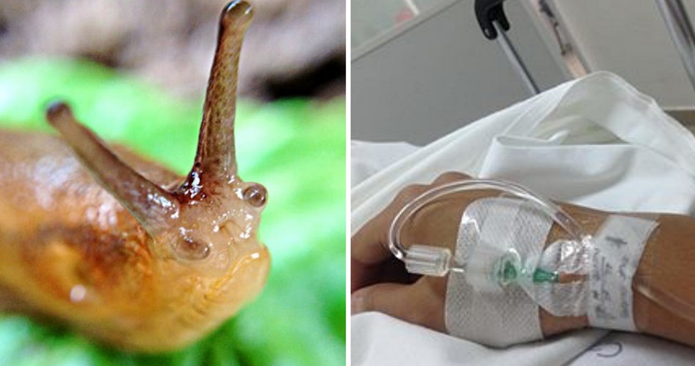 Teenager Dared by Friends to Eat Slug, Falls into Coma & Dies 8 Years Later - WORLD OF BUZZ 2