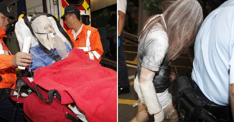 Uni Students Throw Flour Around During B'day Party, Triggers Explosion and Flames - WORLD OF BUZZ 7