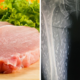 Woman's Love for Eating Raw Meat Causes Her Legs to Be Infected with Parasitic Worms - WORLD OF BUZZ 2