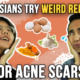 Malaysians Try Weird Remedies For Acne Scars - WORLD OF BUZZ 1