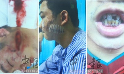 M'sian Man Gets Viciously Beaten Up in Kepong Bar for Saying "If You Can't Drink, Then Go Home" - WORLD OF BUZZ 7