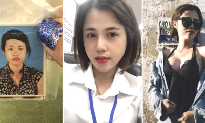 This Single Mother Abandoned For Being Ugly, Turns Her Life Around With Plastic Surgery - WORLD OF BUZZ