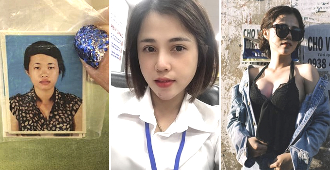 This Single Mother Abandoned For Being Ugly, Turns Her Life Around With Plastic Surgery - WORLD OF BUZZ