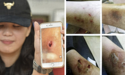 20 People Suffer Contagious Bacterial Infection After Visiting Massage Parlour In Kuchai Lama - WORLD OF BUZZ