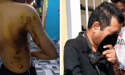 M'sian Man Arrested for Scalding 8yo Daughter With Boiling Water Could Face 10 Years in Jail - WORLD OF BUZZ