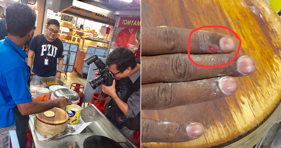 Photos of Mamak Employee Making Dough With Open Wound on Finger Goes Viral - WORLD OF BUZZ