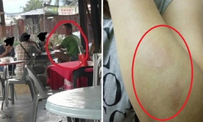 Smokers Use Stick to Beat Up Kepong Food Stall Workers After They Were Asked to Stop Smoking - WORLD OF BUZZ 3