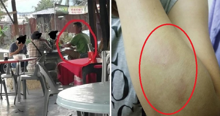 Smokers Use Stick to Beat Up Kepong Food Stall Workers After They Were Asked to Stop Smoking - WORLD OF BUZZ 3