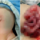 Baby's Intestines Spilled Out Of His Stomach After Father Made A Small Cut To Let Out Gas - WORLD OF BUZZ 4