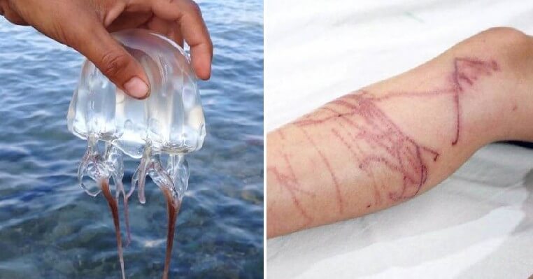 Expert Warns That Increased Amount of Deadly Box Jellyfish Expected to Invade Sabah From March Until June - WORLD OF BUZZ 2