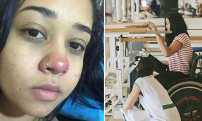 Girl Becomes Paralysed After Piercing Her Nose Due to Bacterial Infection - WORLD OF BUZZ