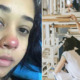 Girl Becomes Paralysed After Piercing Her Nose Due to Bacterial Infection - WORLD OF BUZZ
