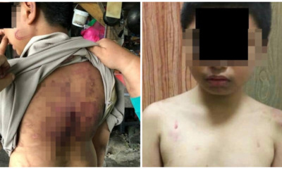 Johorean Boy Abused by Stepfather and Mum with Rice Cooker Cable - WORLD OF BUZZ 1