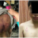 Johorean Boy Abused by Stepfather and Mum with Rice Cooker Cable - WORLD OF BUZZ 1