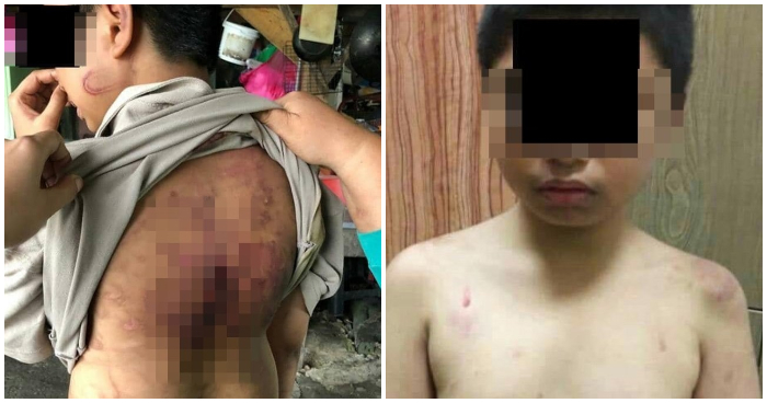 Johorean Boy Abused by Stepfather and Mum with Rice Cooker Cable - WORLD OF BUZZ 1