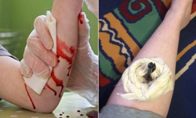 Msian Nurse Says It's Dangerous to Pull Out Knife, Shares 8 Ways to Help Injured Person - WORLD OF BUZZ