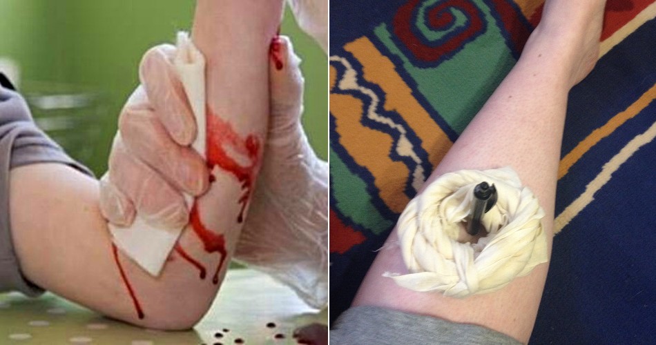 Msian Nurse Says It's Dangerous to Pull Out Knife, Shares 8 Ways to Help Injured Person - WORLD OF BUZZ