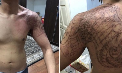 Msian Shares His Horrific Experience Using  'Halal Tattoo', Causing Severe "Burns" on Skin - WORLD OF BUZZ