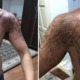 Msian Shares His Horrific Experience Using  'Halal Tattoo', Causing Severe "Burns" on Skin - WORLD OF BUZZ