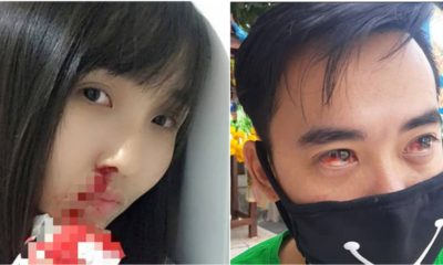 Pollution In Bangkok Is So Bad That The Citizens Are Coughing Blood - WORLD OF BUZZ 7