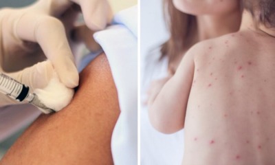 This Country Was Measles-Free For 5 Years Until an Unvaccinated Child Recently Went There on Vacation - WORLD OF BUZZ 5