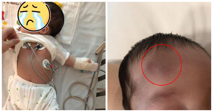 This Poor Infant Now Has Blood Clots and 2 Broken Bones After His Nanny Dropped Him Down the Stairs - WORLD OF BUZZ 3