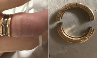Woman Receives Ring Worth RM28,000 On Valentine's, Had To Cut It Off As Finger Was Too Thick - WORLD OF BUZZ