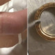 Woman Receives Ring Worth RM28,000 On Valentine's, Had To Cut It Off As Finger Was Too Thick - WORLD OF BUZZ