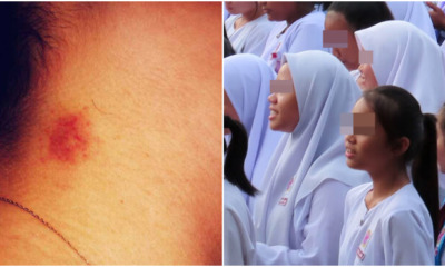 16yo Girl Reveals She Had Sex with 5 Guys After Mum Questions Her About Hickey - WORLD OF BUZZ 2