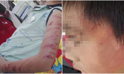 6yo Boy Abused by Half Brother Allegedly for Not Knowing How to Do Maths Homework - WORLD OF BUZZ