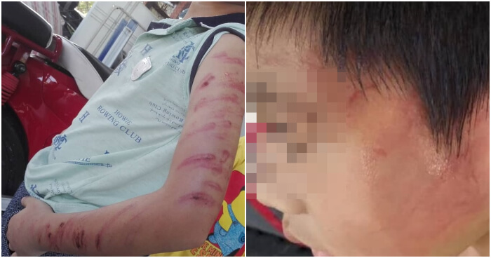 6yo Boy Abused by Half Brother Allegedly for Not Knowing How to Do Maths Homework - WORLD OF BUZZ