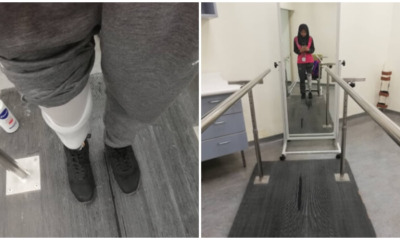 Amputee Shares Positivity, Strength Despite Facing Her Biggest Challenge - WORLD OF BUZZ 6