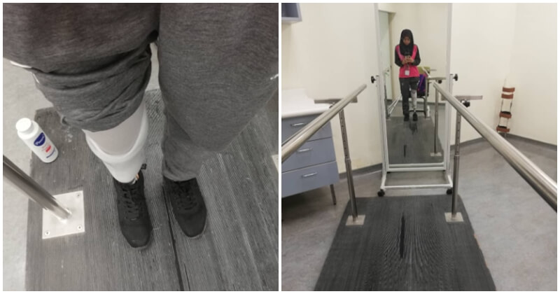 Amputee Shares Positivity, Strength Despite Facing Her Biggest Challenge - WORLD OF BUZZ 6