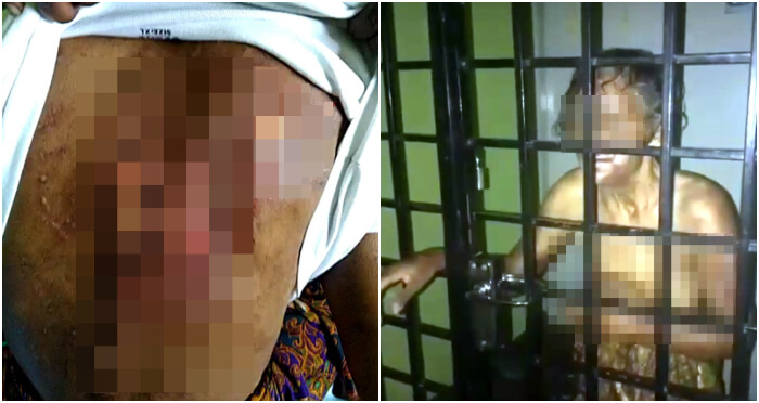 Family of 64yo Penang Woman Suspected of Abusing Her, She Denies It And Says She Was Injured by Fall - WORLD OF BUZZ