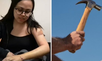 Malaysian Studying in London Gets Attacked With Hammer by Fellow Hostel Resident - WORLD OF BUZZ 3