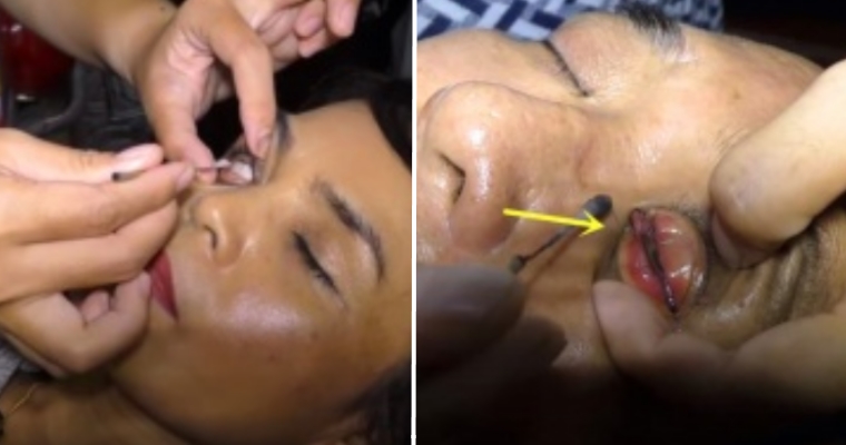 Malaysia's Only "Eye-Washing" Specialist Shop Is Over 80 Years Old! - WORLD OF BUZZ 10